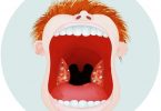 Prichiny-belyh-pyaten-na-gorle-i-metody-ih-lecheniya